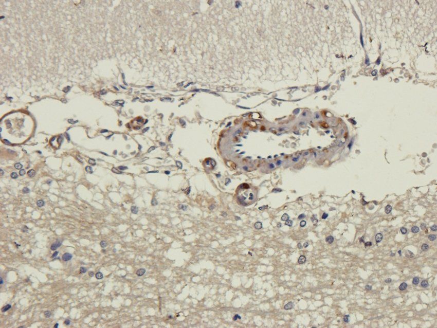 PDE1C Rabbit Polyclonal Antibody