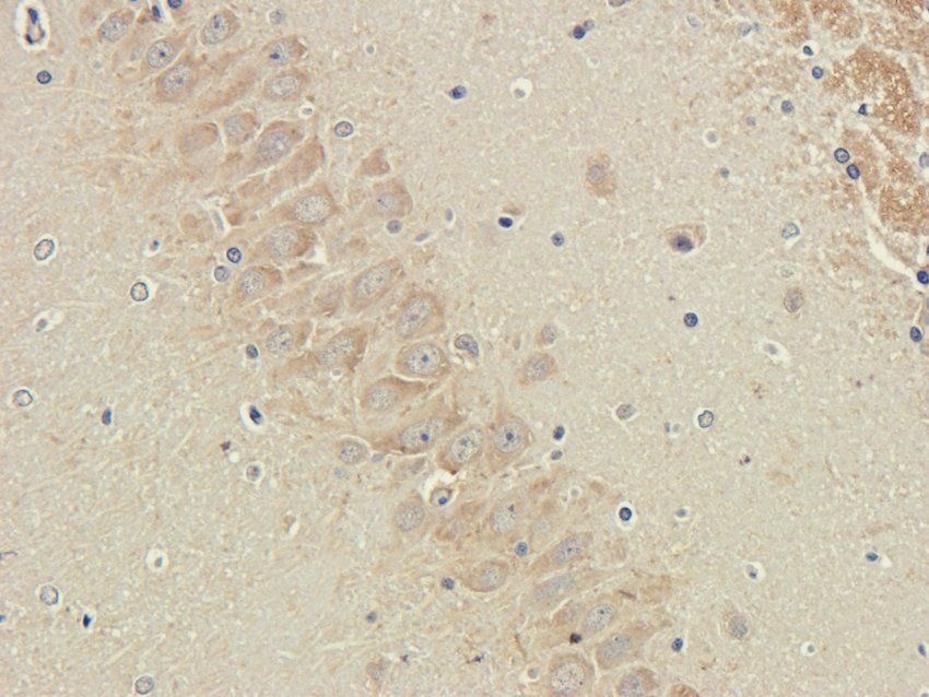 PDE1C Rabbit Polyclonal Antibody