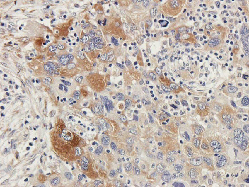 PDE1C Rabbit Polyclonal Antibody