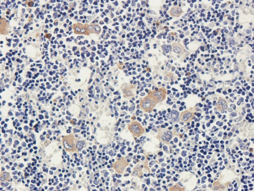PDE1C Rabbit Polyclonal Antibody