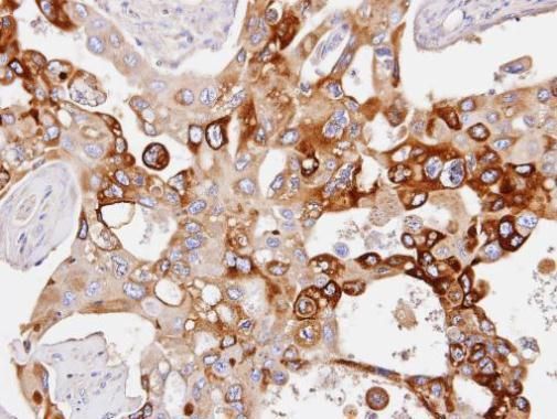 PDE4D Rabbit Polyclonal Antibody