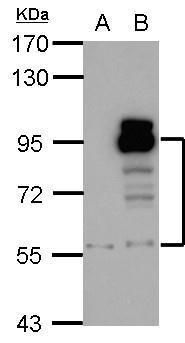 PDE4D Rabbit Polyclonal Antibody