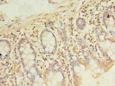 PDE6D Antibody