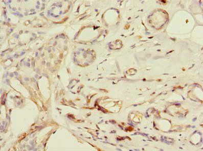 PDE6D Antibody
