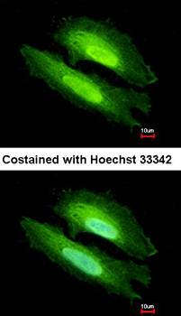 PDE6D antibody