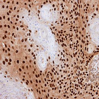 PDE6D antibody
