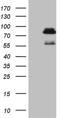 PDGF Receptor alpha Antibody