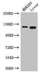 PDGFRA Antibody