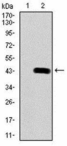 PDGFRB Antibody
