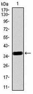 PDGFRB Antibody