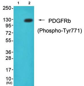 PDGFRb (Phospho-Tyr771) Antibody