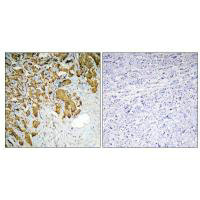 PDHA1 Antibody
