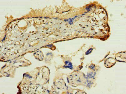 PDIA5 Antibody