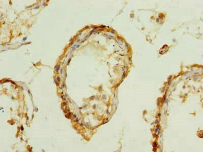 PDIA5 Antibody