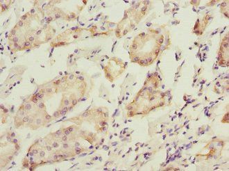 PDIA6 Antibody