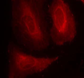 PDK1 (Phospho-Ser241) Antibody