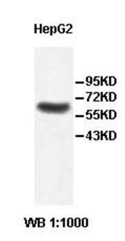 PDK3 Rabbit Polyclonal Antibody