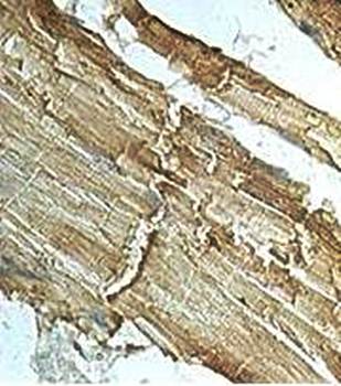 PDK3 Rabbit Polyclonal Antibody