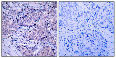 PDPK1 Antibody