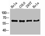 PDPK1 Antibody