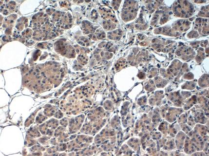 Rabbit Human PDX1 Antibody