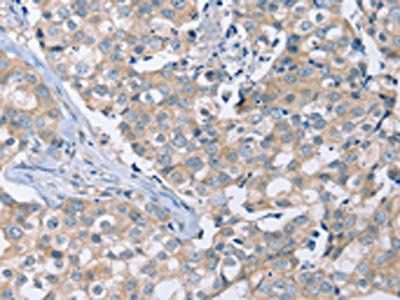 PEA15 Antibody