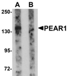 PEAR1 Rabbit Polyclonal Antibody
