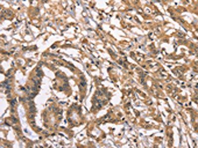 PEBP1 Antibody