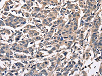 PEBP1 Antibody