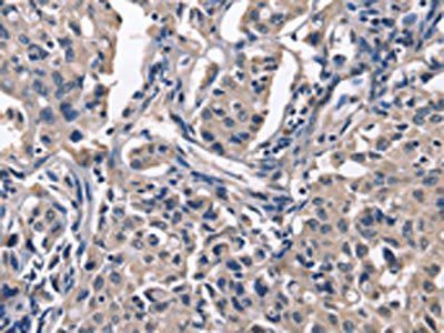 PEBP1 Antibody