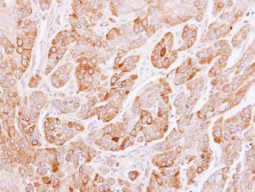 PEF1 Rabbit Polyclonal Antibody