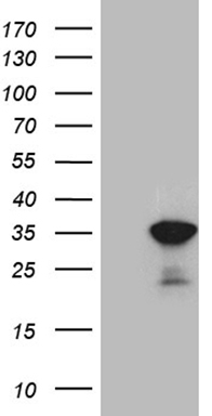 Pepsinogen II Antibody