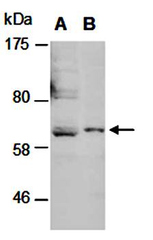 PERFORIN (M) Antibody, Rabbit Polyclonal