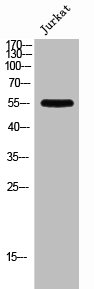 PFKFB1 Antibody