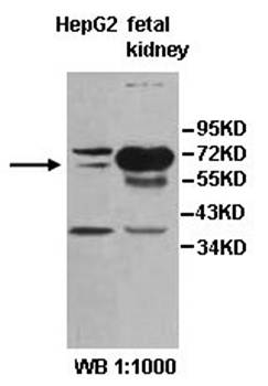 PFKFB3 Rabbit Polyclonal Antibody
