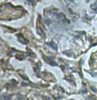 PFKFB3 Rabbit Polyclonal Antibody