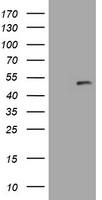 PFKP Antibody