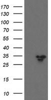 PFKP Antibody