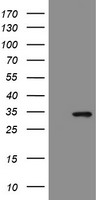 PFKP Antibody