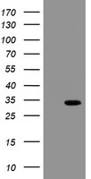 PFKP Antibody