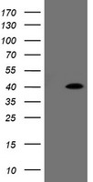 PFKP Antibody