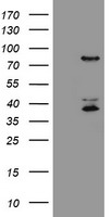 PFKP Antibody