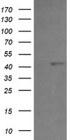 PFKP Antibody