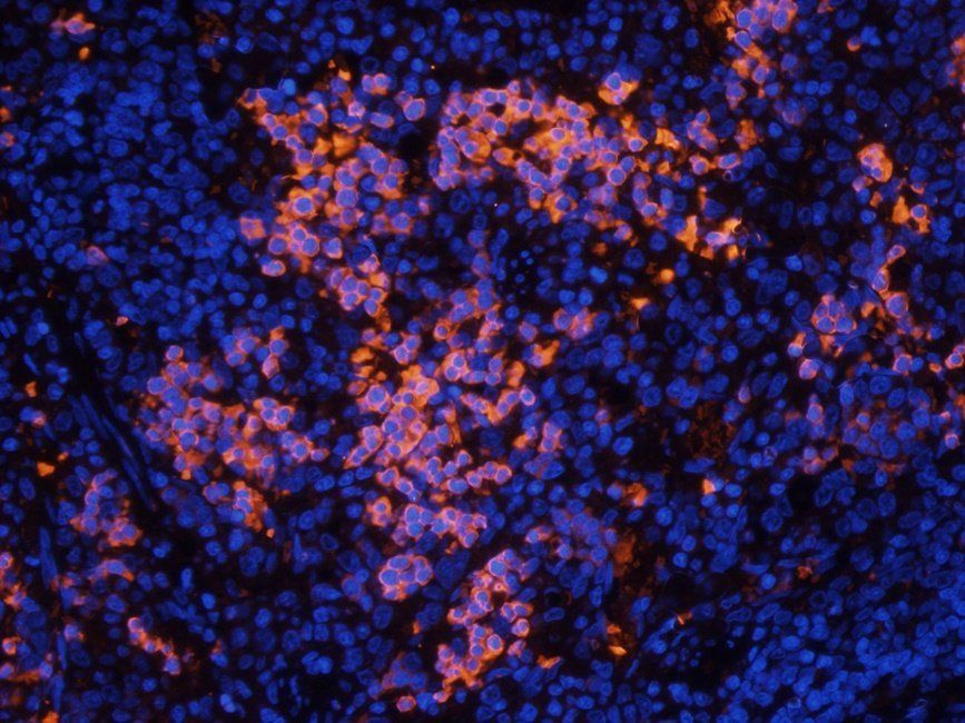 PGBD5 Rabbit Polyclonal Antibody