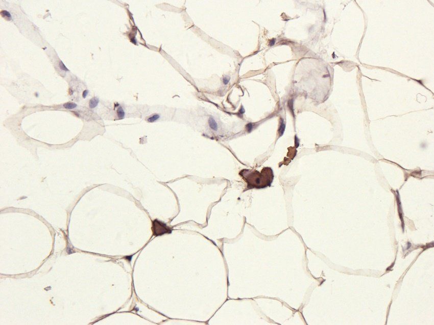 PGBD5 Rabbit Polyclonal Antibody