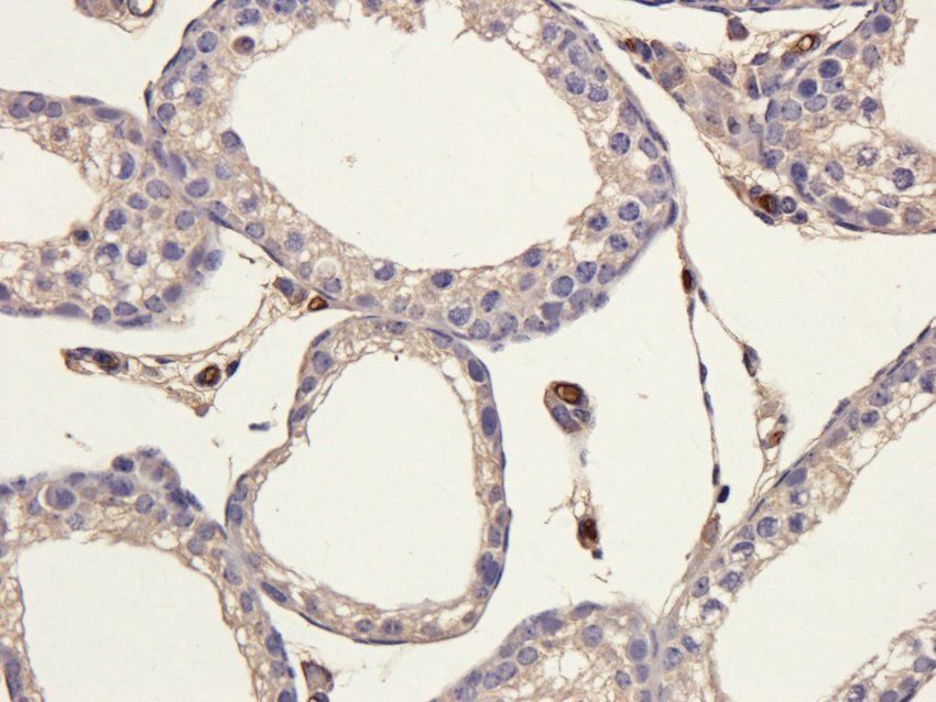 PGBD5 Rabbit Polyclonal Antibody