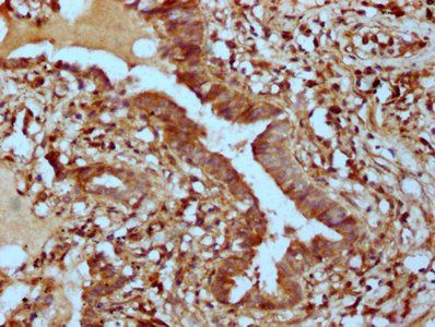 PHACTR1 Antibody