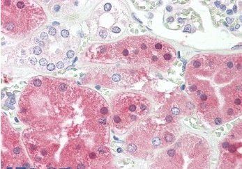 Phenylalanine Hydroxylase Antibody