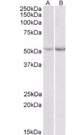 Phenylalanine Hydroxylase Antibody