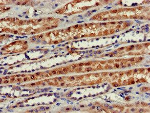 PHOSPHO1 Antibody